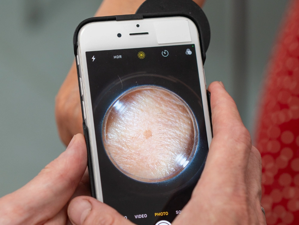 The Lighthouse Clinic Teledermatology